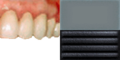 HMPDFT-Teeth1.png